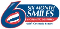 Six Month Smiles Invisable Braces