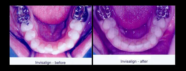 Case05